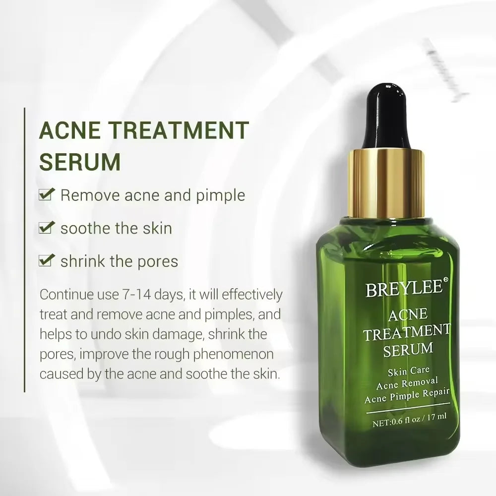 Acne Treatment Serum Facial Essence