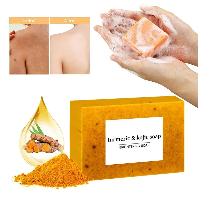 Turmeric  Soap Lemon Kojic Soap Bath Soap Face Soap Clean Skin Oil Control Natural Ingredients For Acne Skin Care