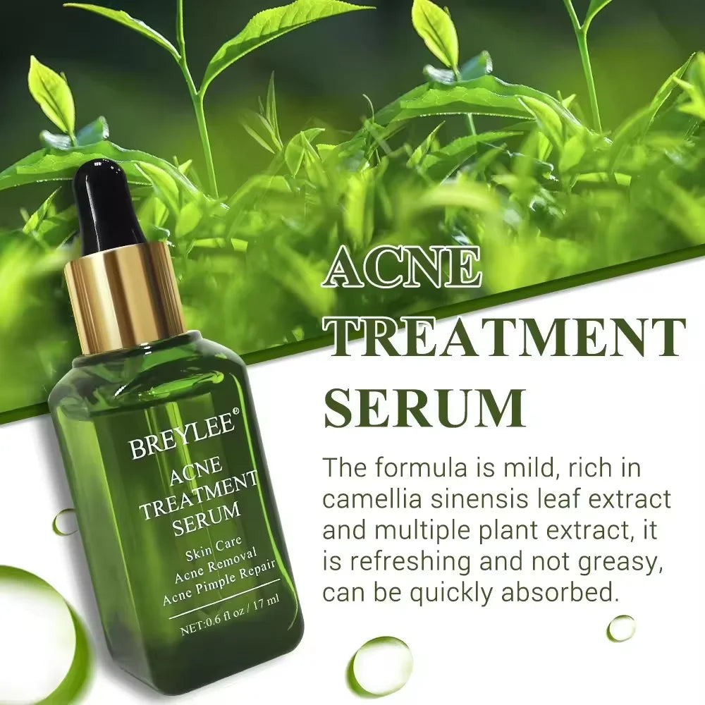 Acne Treatment Serum Facial Essence