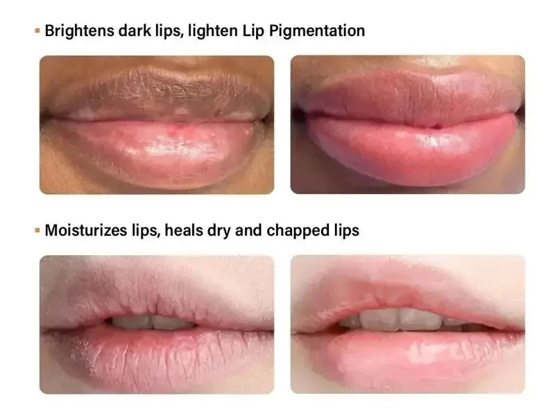 Lip Balm Lightening Melanin Bleaching Gloss Oil Lips Pink Lipstick Exfoliating Fade Lip Lines