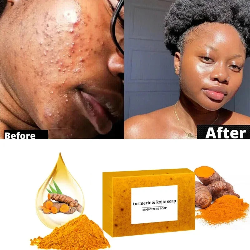 Turmeric  Soap Lemon Kojic Soap Bath Soap Face Soap Clean Skin Oil Control Natural Ingredients For Acne Skin Care