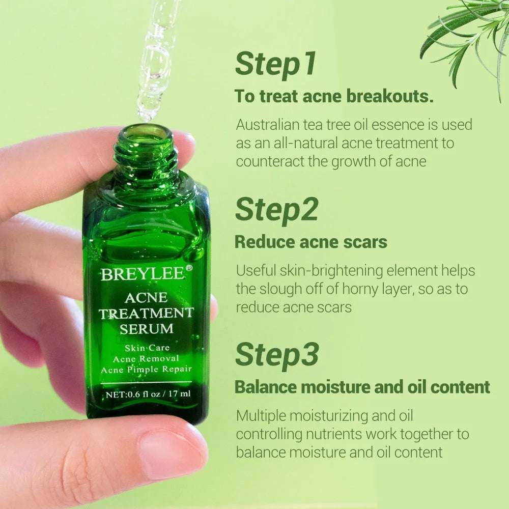 Acne Treatment Serum Facial Essence