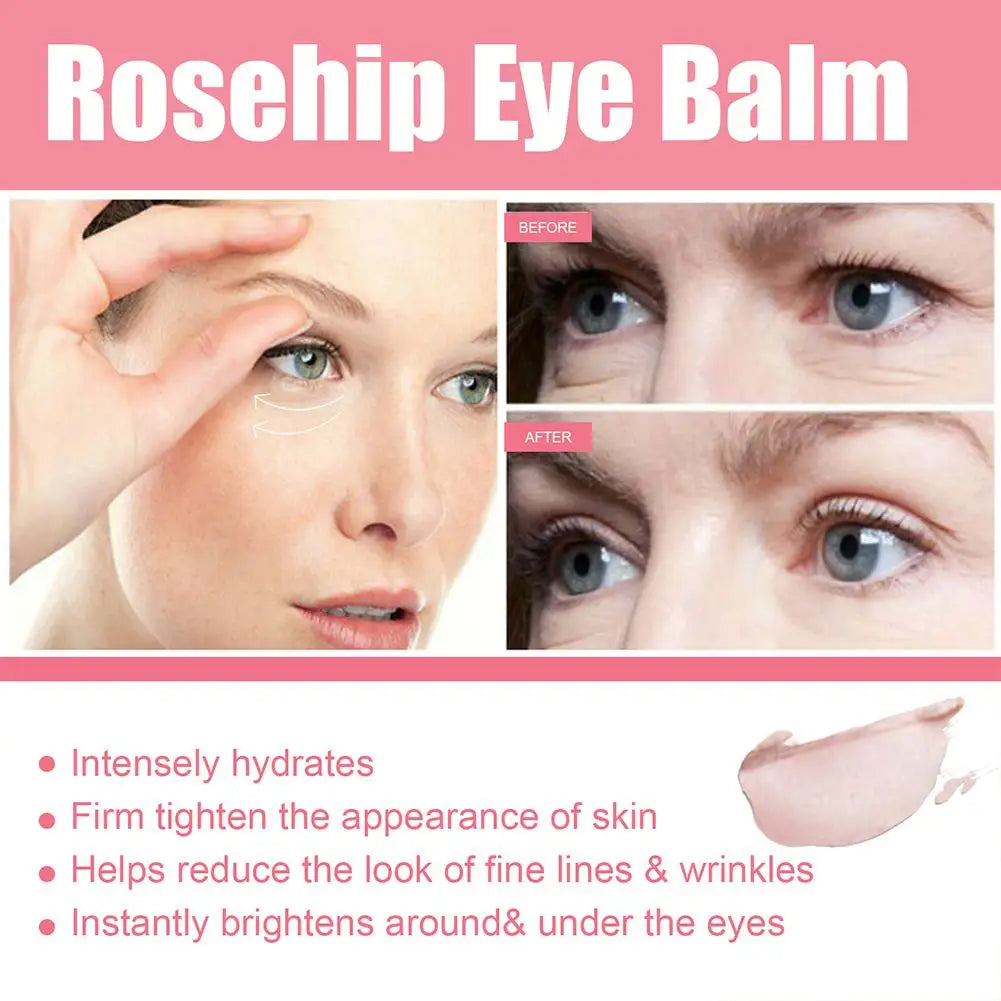 Rose Hip Eye Cream Eye Care Anti-puffiness Elimination Of Dark Circles And Wrinkles Brightening And Moisturizing Feminine Care